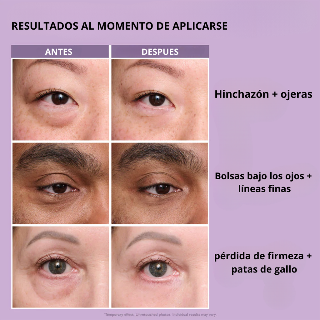 Crema antibolsas y ojeras Olenza®